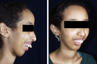 jaw corrective treatment