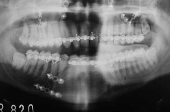 Maxillofacial Trauma center in guntur