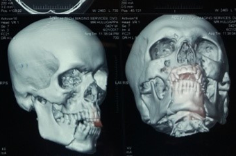 Maxillofacial Trauma center in guntur