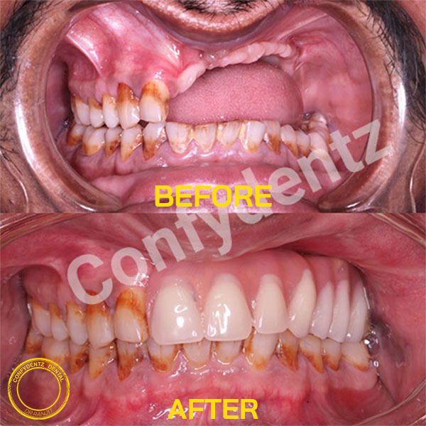 Confydentz dental case reports