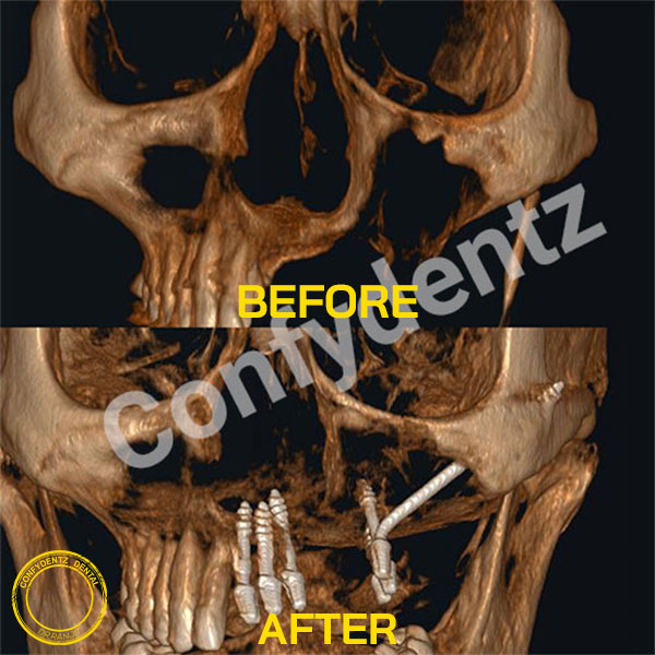 Confydentz dental case reports