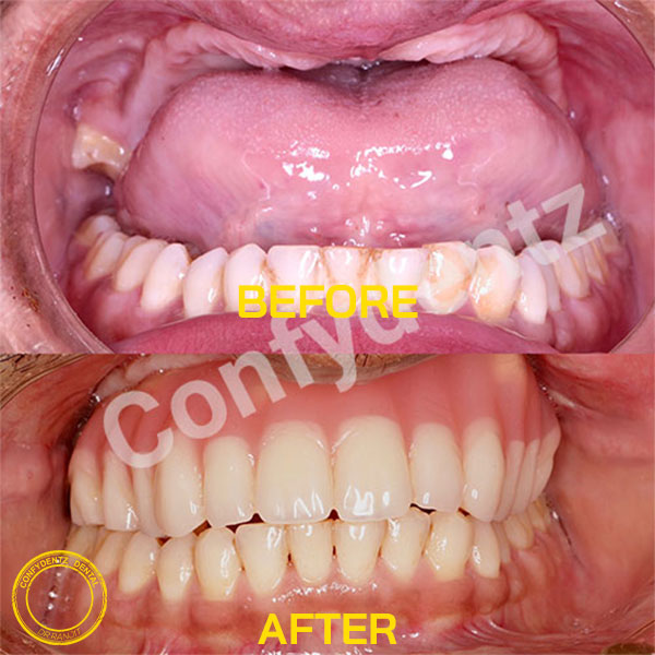 Confydentz dental case reports