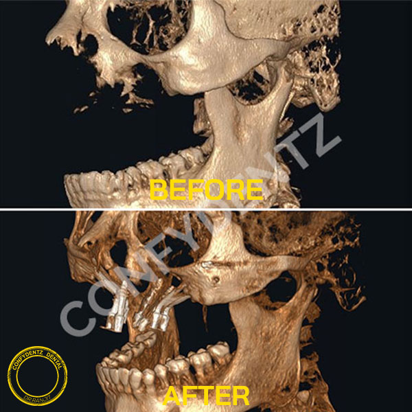 Confydentz dental case reports