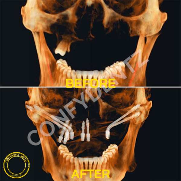 Confydentz dental case reports