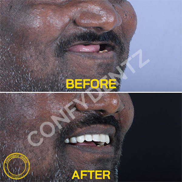 Confydentz dental case reports