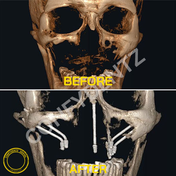 Confydentz dental case reports