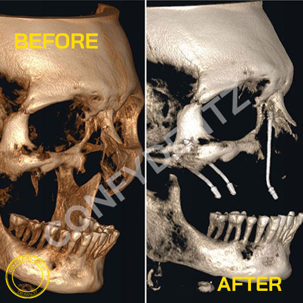 Confydentz dental case reports