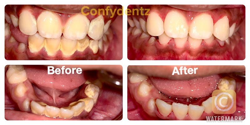 Confydentz dental case reports