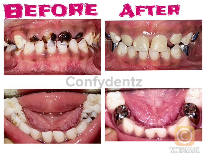 Confydentz dental case reports