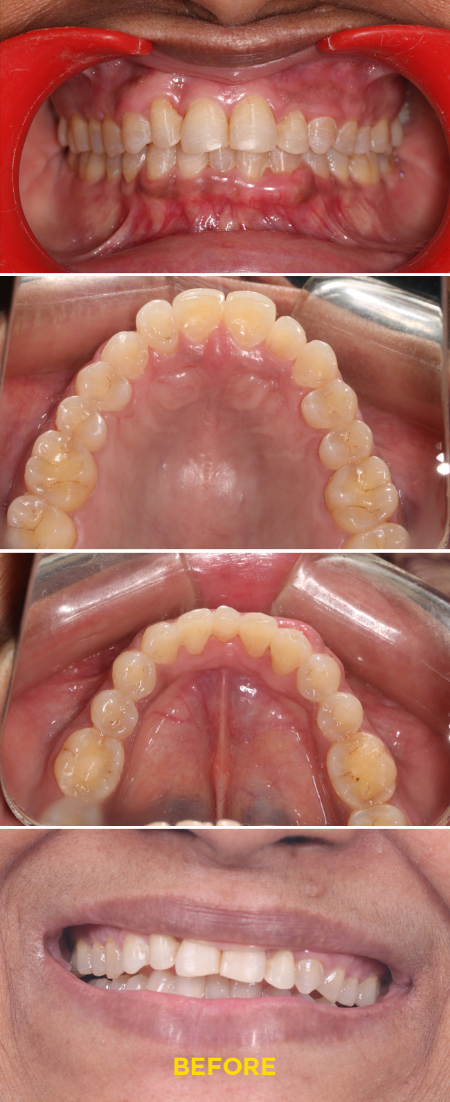 Confydentz dental case reports