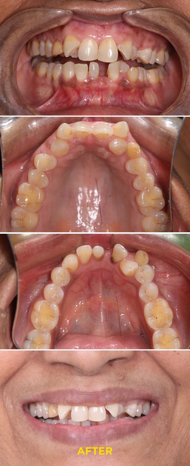 Confydentz dental case reports