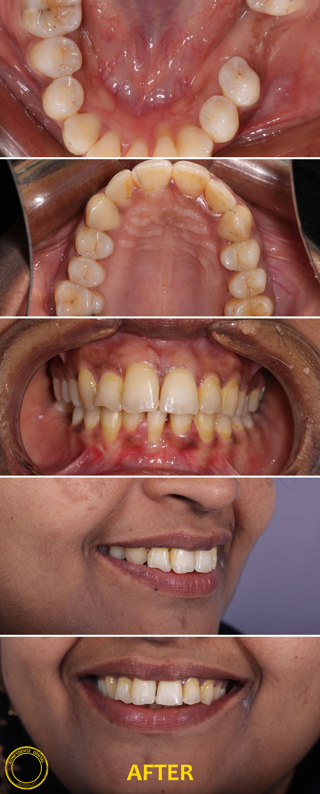 Confydentz dental case reports