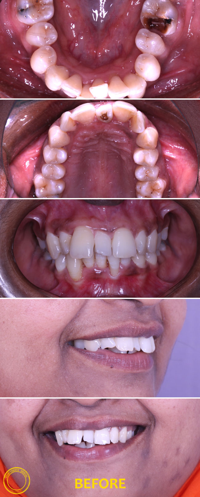 Confydentz dental case reports