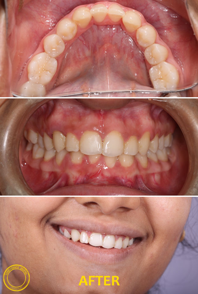 Confydentz dental case reports