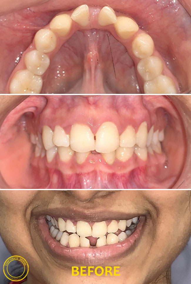 Confydentz dental case reports