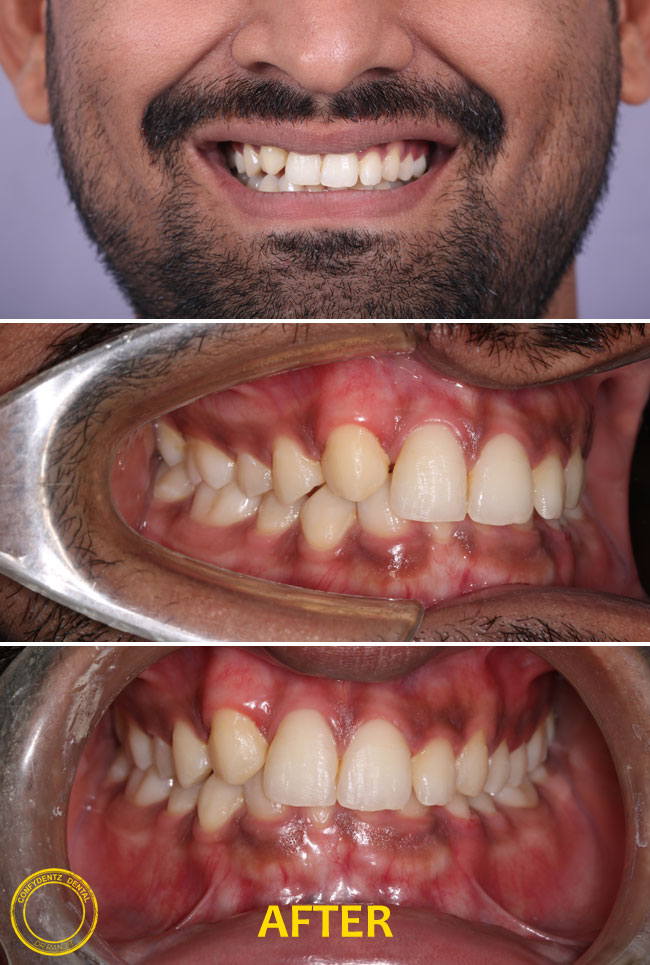 Confydentz dental case reports