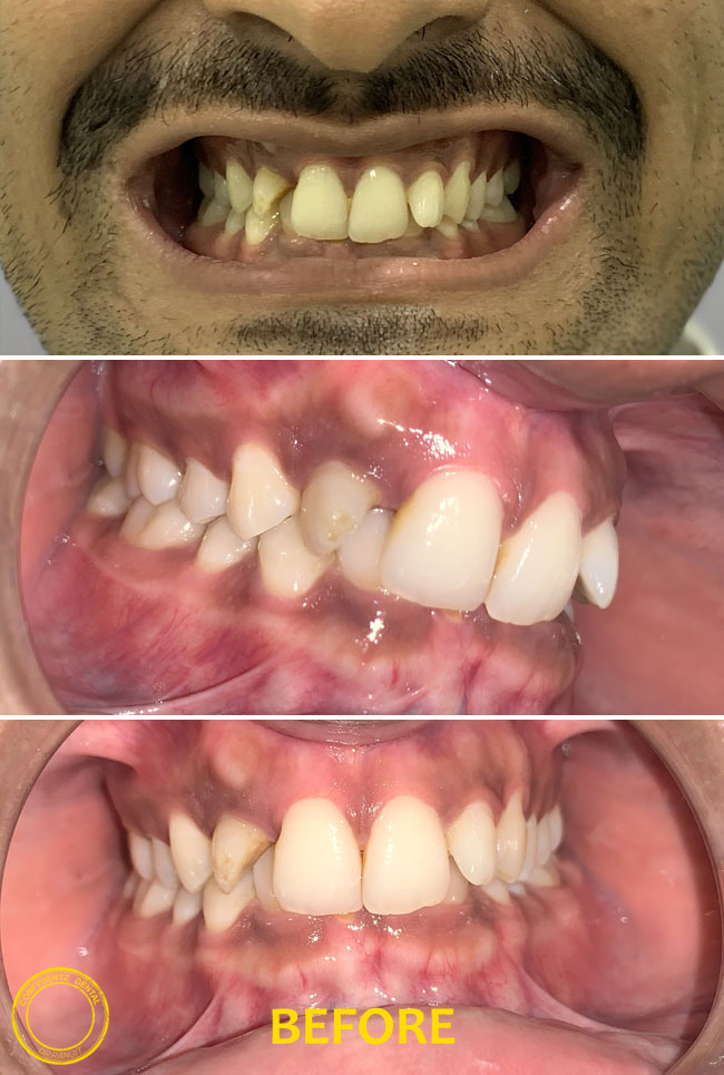 Confydentz dental case reports