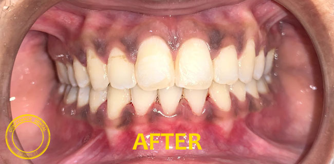 Confydentz dental case reports