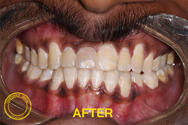 Confydentz dental case reports