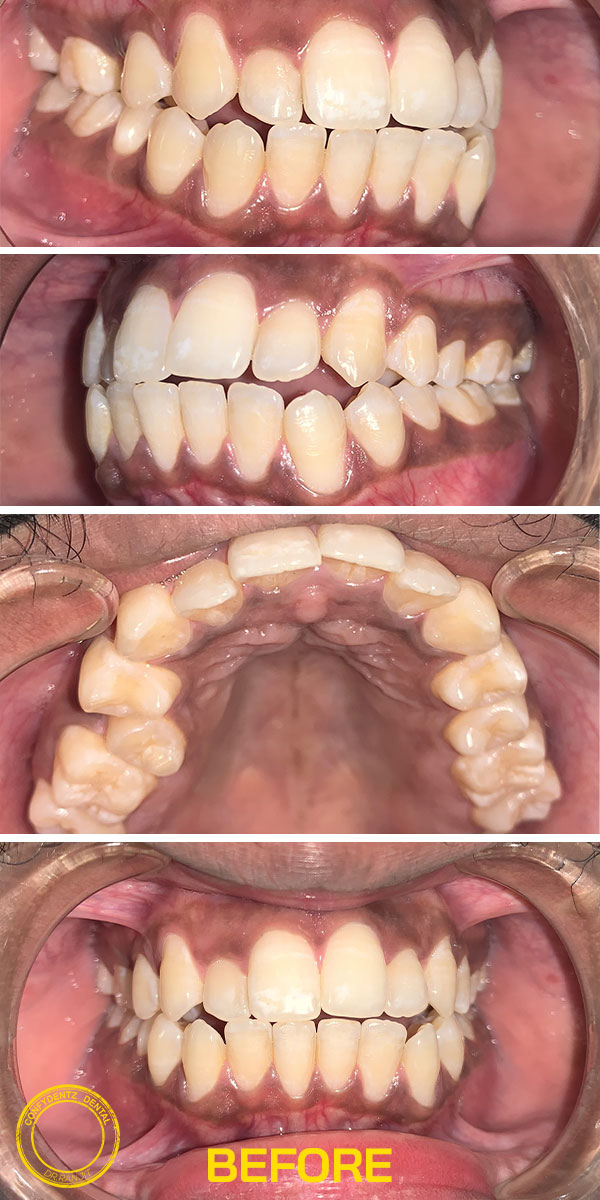 Confydentz dental case reports