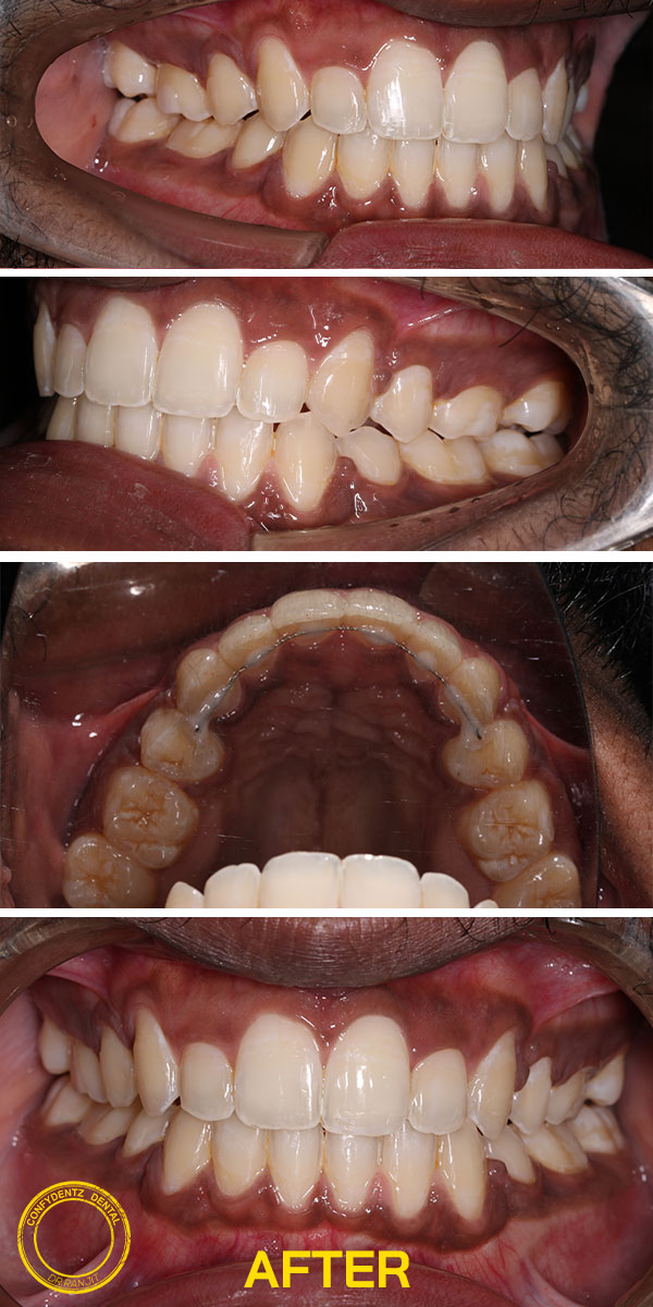 Confydentz dental case reports