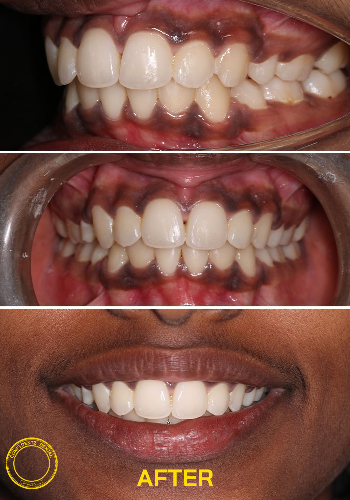 Confydentz dental case reports