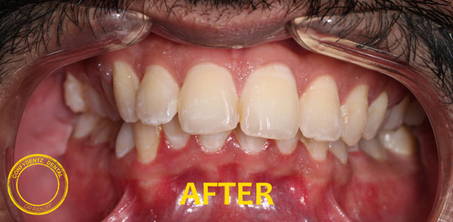 Confydentz dental case reports