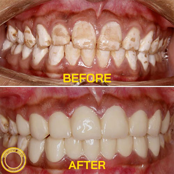 Confydentz dental case reports