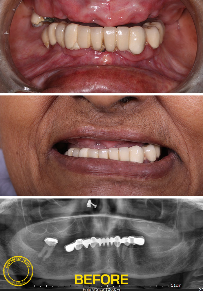 Confydentz dental case reports