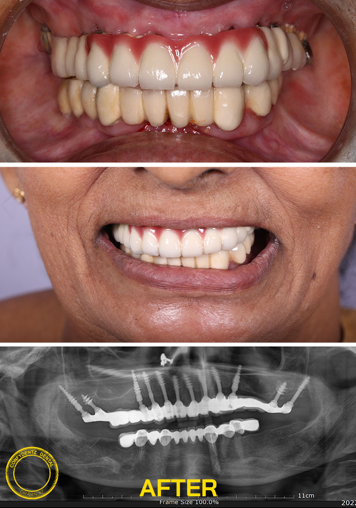 Confydentz dental case reports