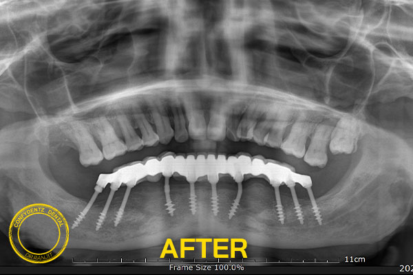 Confydentz dental case reports