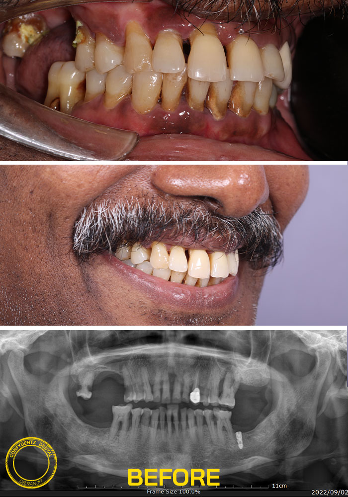 Confydentz dental case reports