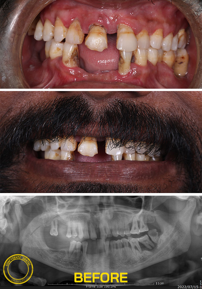 Confydentz dental case reports