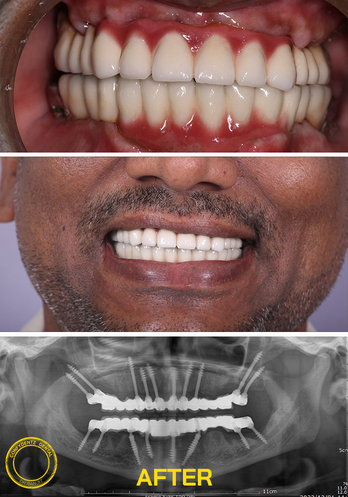 Confydentz dental case reports