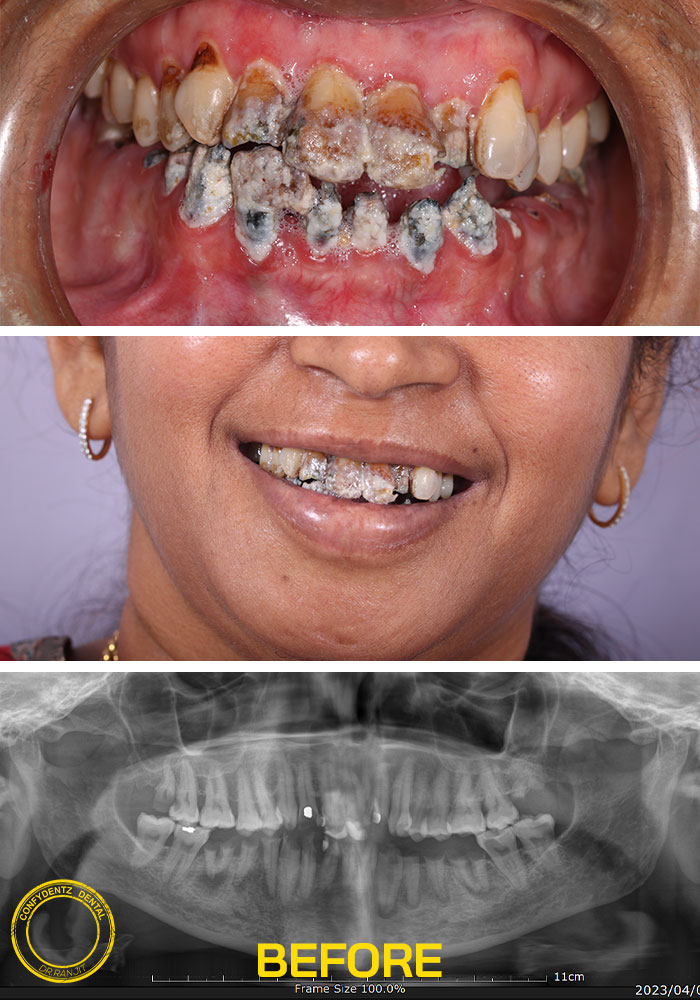 Confydentz dental case reports