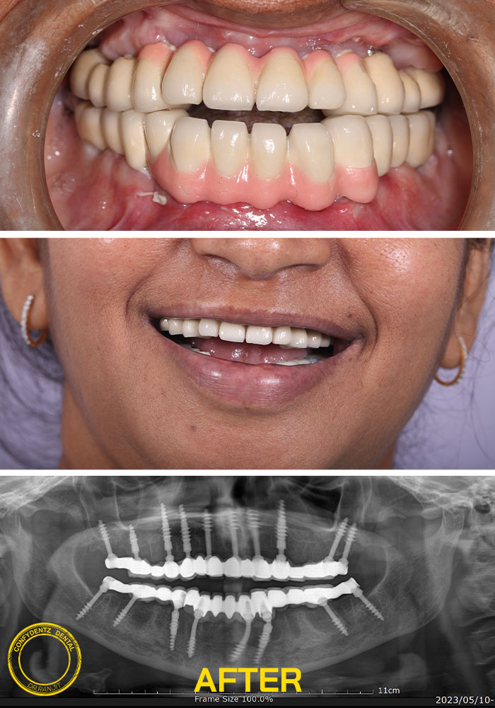 Confydentz dental case reports