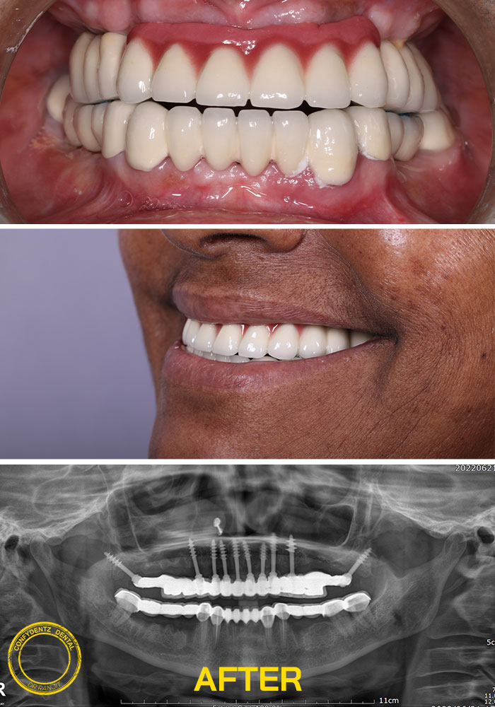 Confydentz dental case reports