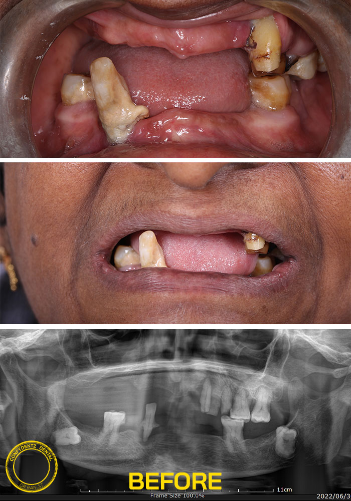 Confydentz dental case reports