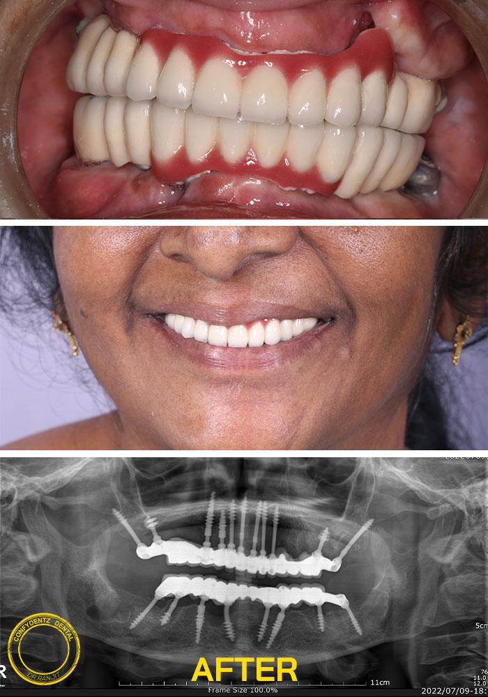 Confydentz dental case reports