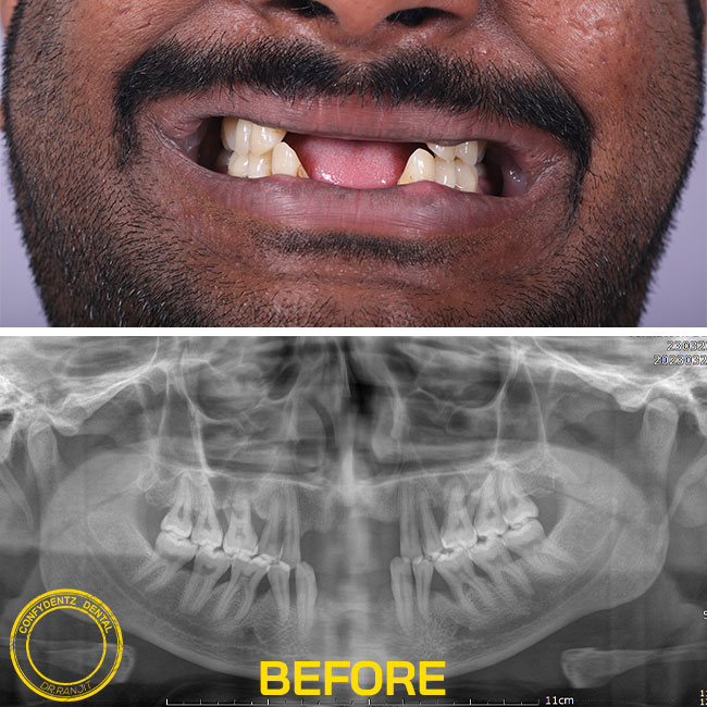 Confydentz dental case reports