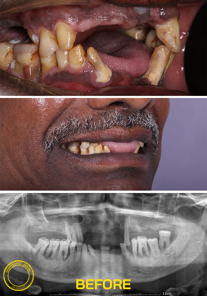 Confydentz dental case reports