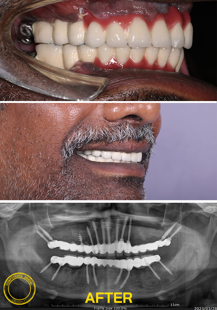 Confydentz dental case reports