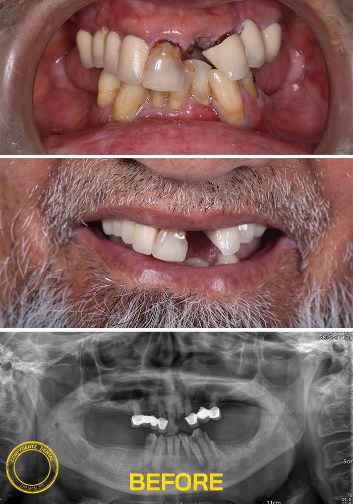 Confydentz dental case reports