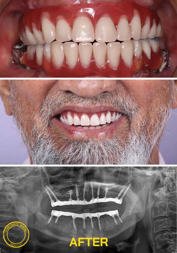 Confydentz dental case reports