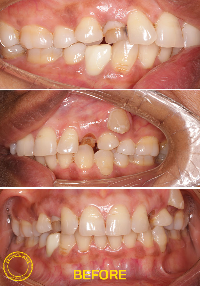 Confydentz dental case reports