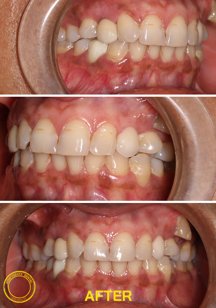 Confydentz dental case reports