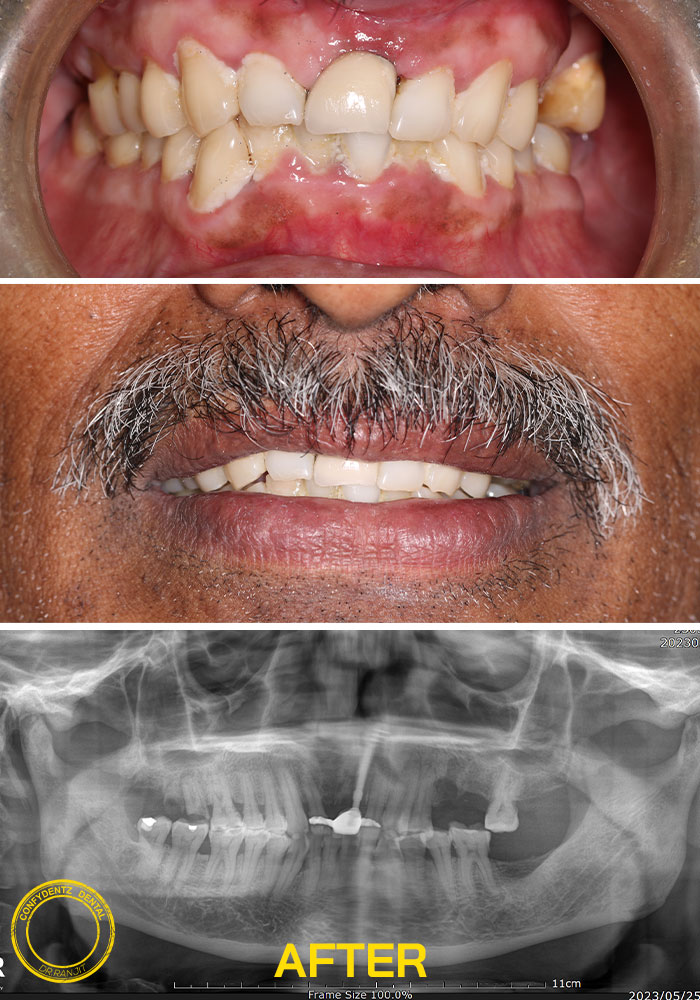 Confydentz dental case reports