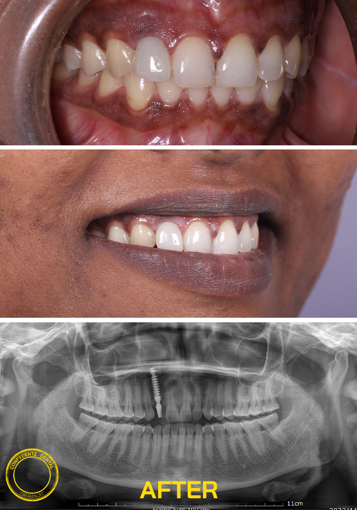 Confydentz dental case reports