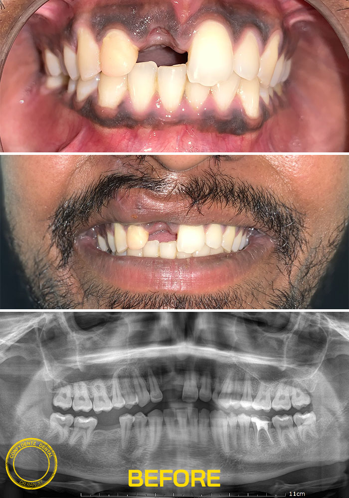 Confydentz dental case reports