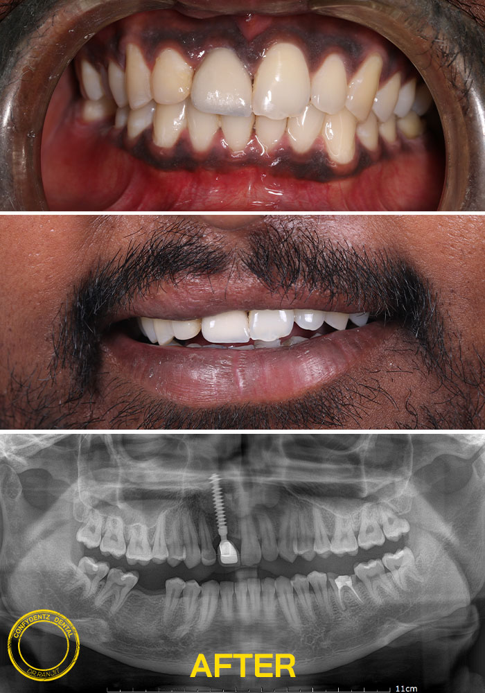 Confydentz dental case reports